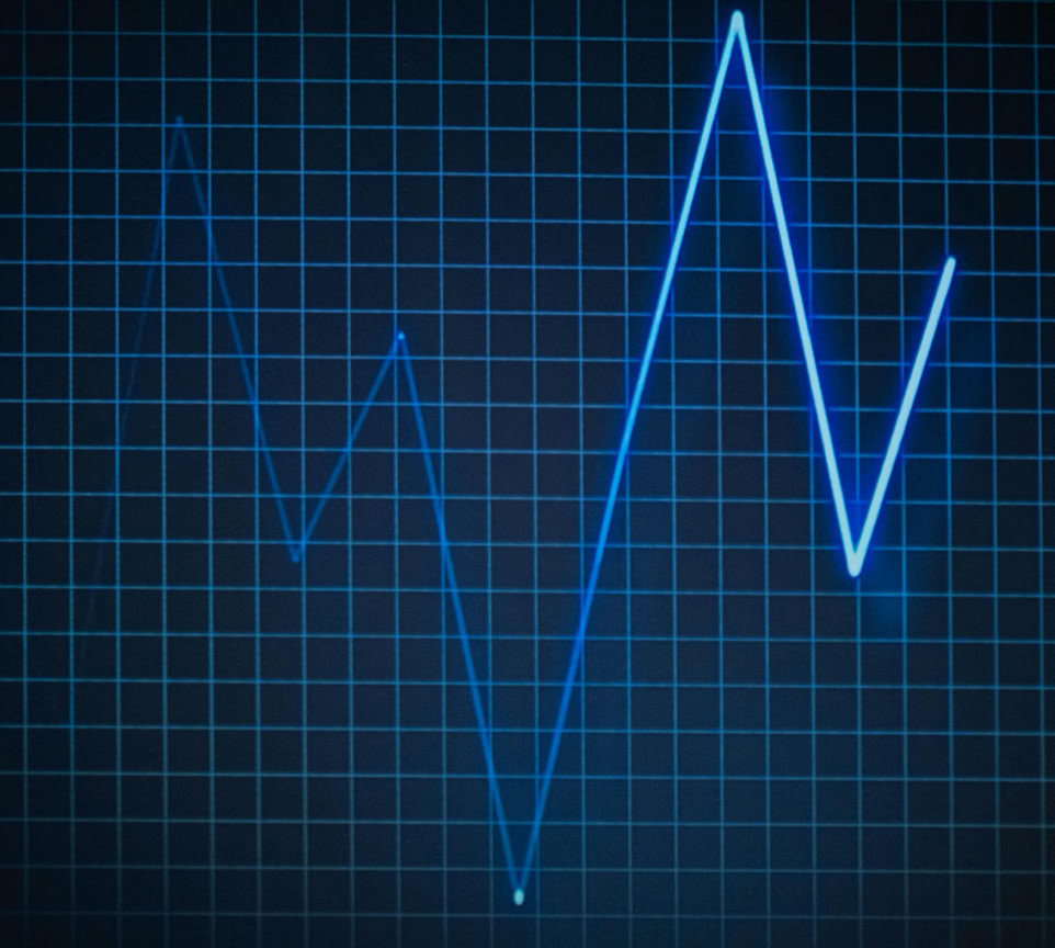 ECG graph on a grid background symbolizing heartbeat and medical data.